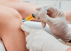 PRP в ортопедії – консультація лікаря та ін'єкції збагаченої плазми у суглоби
