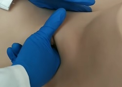 Плановий огляд у гінекології Клініки Медітон – бімануальне дослідження