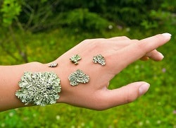 Екзема – лікування у Кривому Розі запальних захворювань шкіри