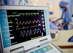 Де зробити кардіограму у Кривому Розі – електрокардіографія серця на Філатова
