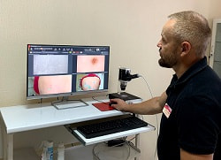 Цифрова дерматоскопія FotoFinder у Кривому Розі – дерматолог, дерматоонколог