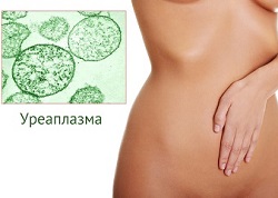 Уреаплазма – діагностика, лікування та профілактика інфекції в Кривому Розі
