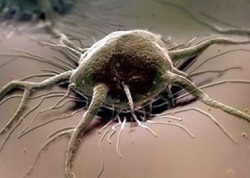 Доброякісні та злоякісні новоутворення – відмінності та різниця