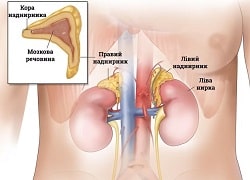 Діагностика захворювань надниркових залоз – патології надниркових залоз