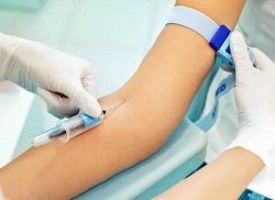 Забір крові на ферменти печінки у Кривому Розі – аналізи на Філатова та Поштовому