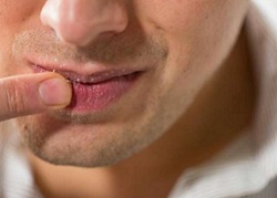 Постійний присмак солі в роті – лікування в Кривому Розі, Клініка Медітон