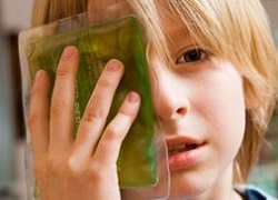 Лікування ударів голови та м'яких тканин обличчя, забоїв скроні та вилиці, травм ока